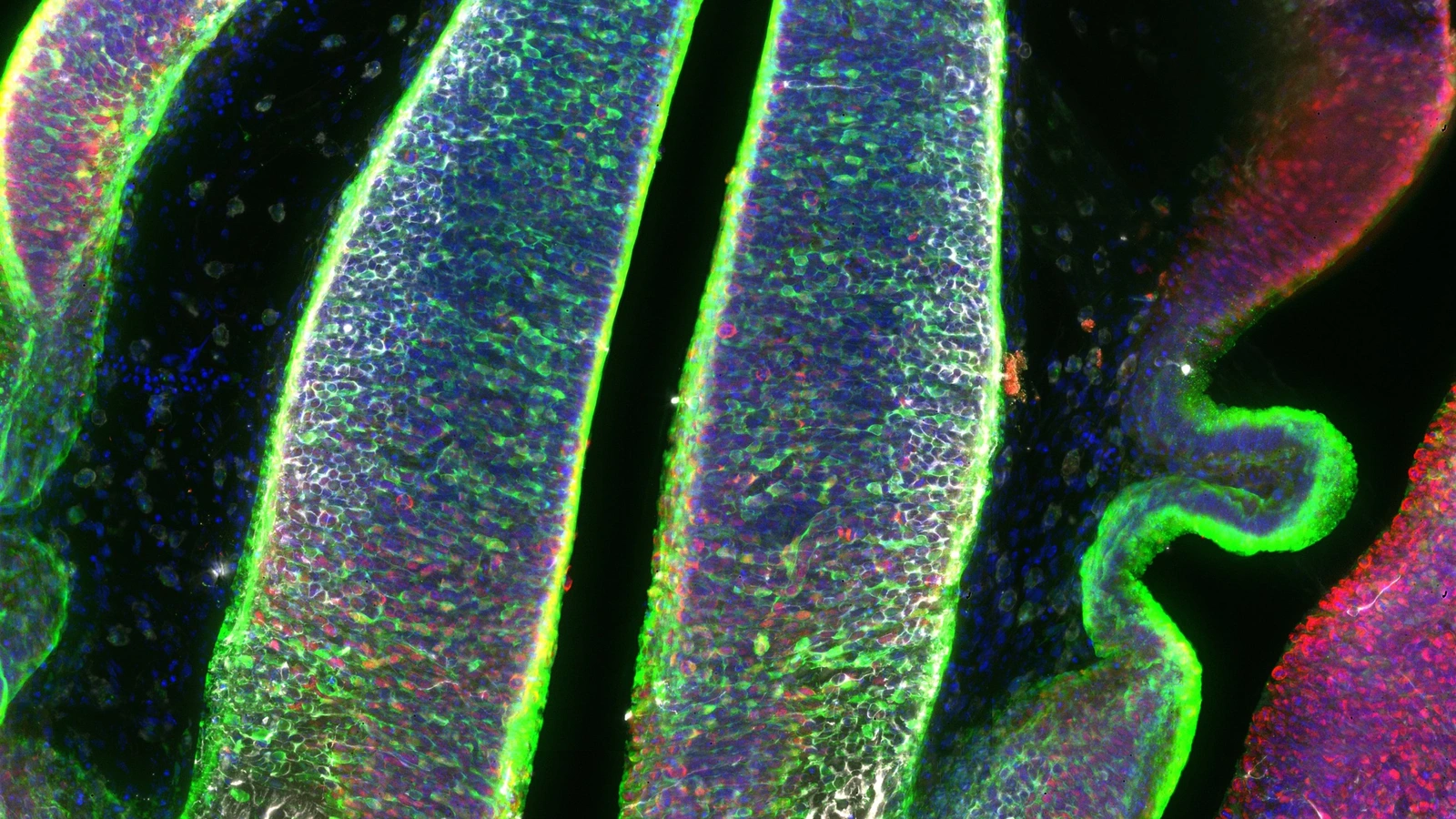 Imagen de microscopía de fluorescencia del tálamo embrionario de ratón con células progenitoras en verde